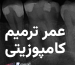 عمر ترمیم کامپوزیت